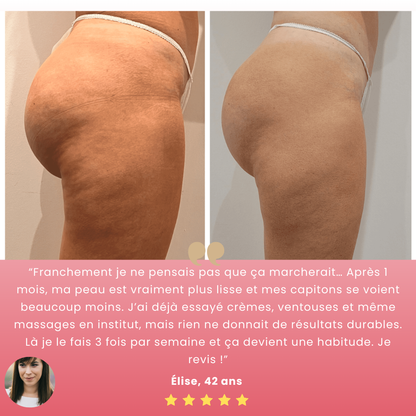 Skinéa™