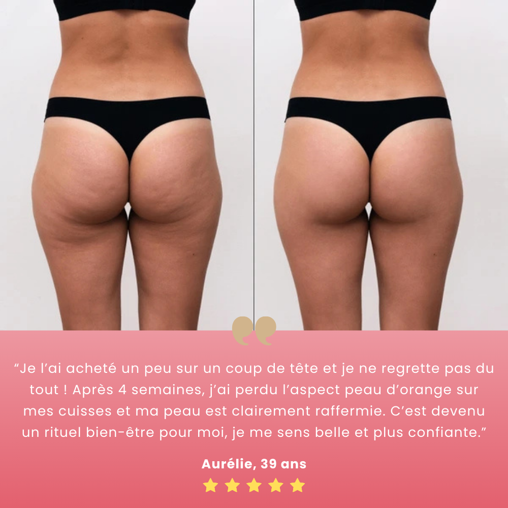 Skinéa™