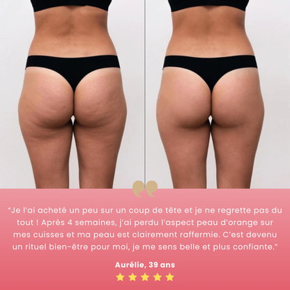 Skinéa™